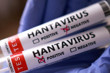 Sağlık Bakanlığı'ndan hantavirüs duyurusu, süreç titizlikle takip ediliyor