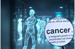 Kanser teşhisinde yapay zekâ dönemi