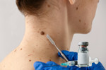 Cilt kanserinde yeni gelişme, mRNA aşısı riski azaltıyor