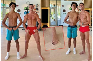 Ronaldo’nun ojesindeki “sır” sağlık sebebi