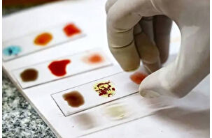 Dünyada sadece 50 kişide görülen kan: Rh null