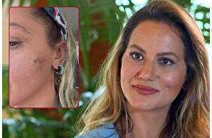 Oyuncu Yıldız Asyalı eş şiddetini paylaştı