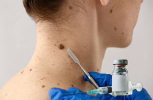 Cilt kanserinde yeni gelişme, mRNA aşısı riski azaltıyor