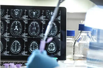 Alzheimer ilacı Donameab’a Avustralya onayı