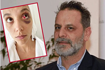 Ozan Güven, eski sevgilisi Deniz Bulutsuz’u kasten yaralama suçundan 2 yıl 3 ay hapis cezasına çarptırıldı