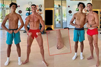 Ronaldo’nun ayak tırnaklarına sürekli oje sürmesi sosyal medyada konuşuldu, sağlık nedeniyle yaptığı ortaya çıktı