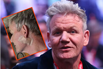 Ünlü yemek şefi Gordon Ramsay, cilt kanserini erken teşhisle atlattı