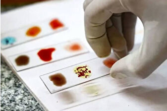 Dünyada sadece 50 kişide bulunan Rh null yani 'altın kan'ın laboratuvarda üretilmesi için çalışmalar hız kazanıyor