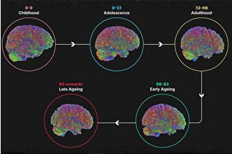 İnsan beyni 5 evreden geçiyor, 32 yaşına kadar ergenlik dönemini yaşıyor