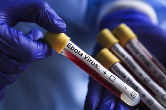Fransa'da Kongo'dan dönen bir doktorda Ebola virüsü görüldü
