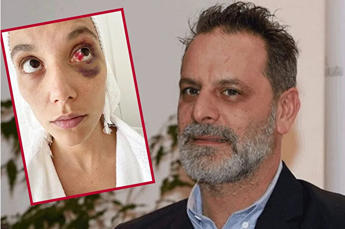 Ozan Güven, eski sevgilisi Deniz Bulutsuz’u kasten yaralama suçundan 2 yıl 3 ay hapis cezasına çarptırıldı