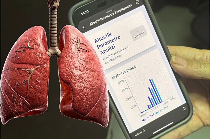 Akciğer sönmesinin erken tespiti amacıyla mobil uygulama geliştirildi