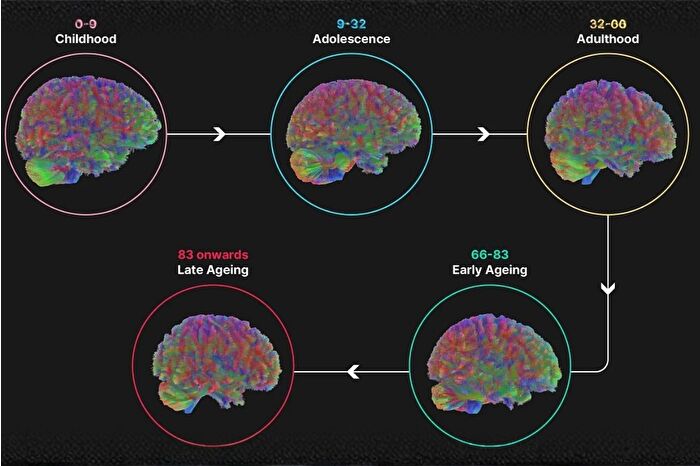 İnsan beyni 5 evreden geçiyor, 32 yaşına kadar ergenlik dönemini yaşıyor