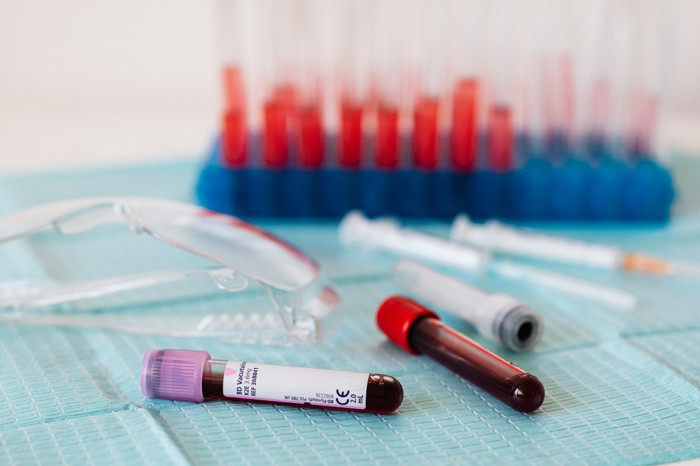 Yeni araştırma Alzheimer hastalığının semptomlar başlamadan yıllar önce kan testiyle tespit edilebileceğini ortaya koydu