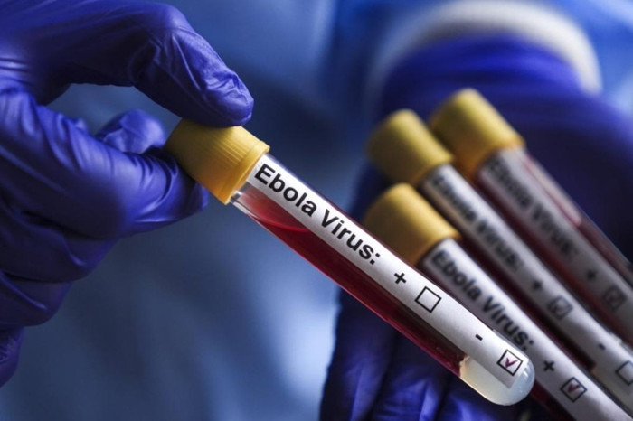 Fransa'da Kongo'dan dönen bir doktorda Ebola virüsü görüldü