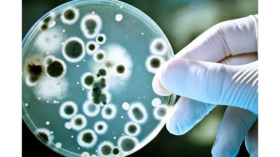 Yapay zeka antibiyotik dirençli bakterileri yok etti