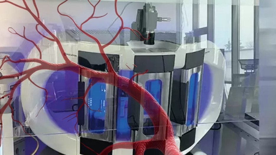 Yapay damar nakli başarıyla tamamlandı