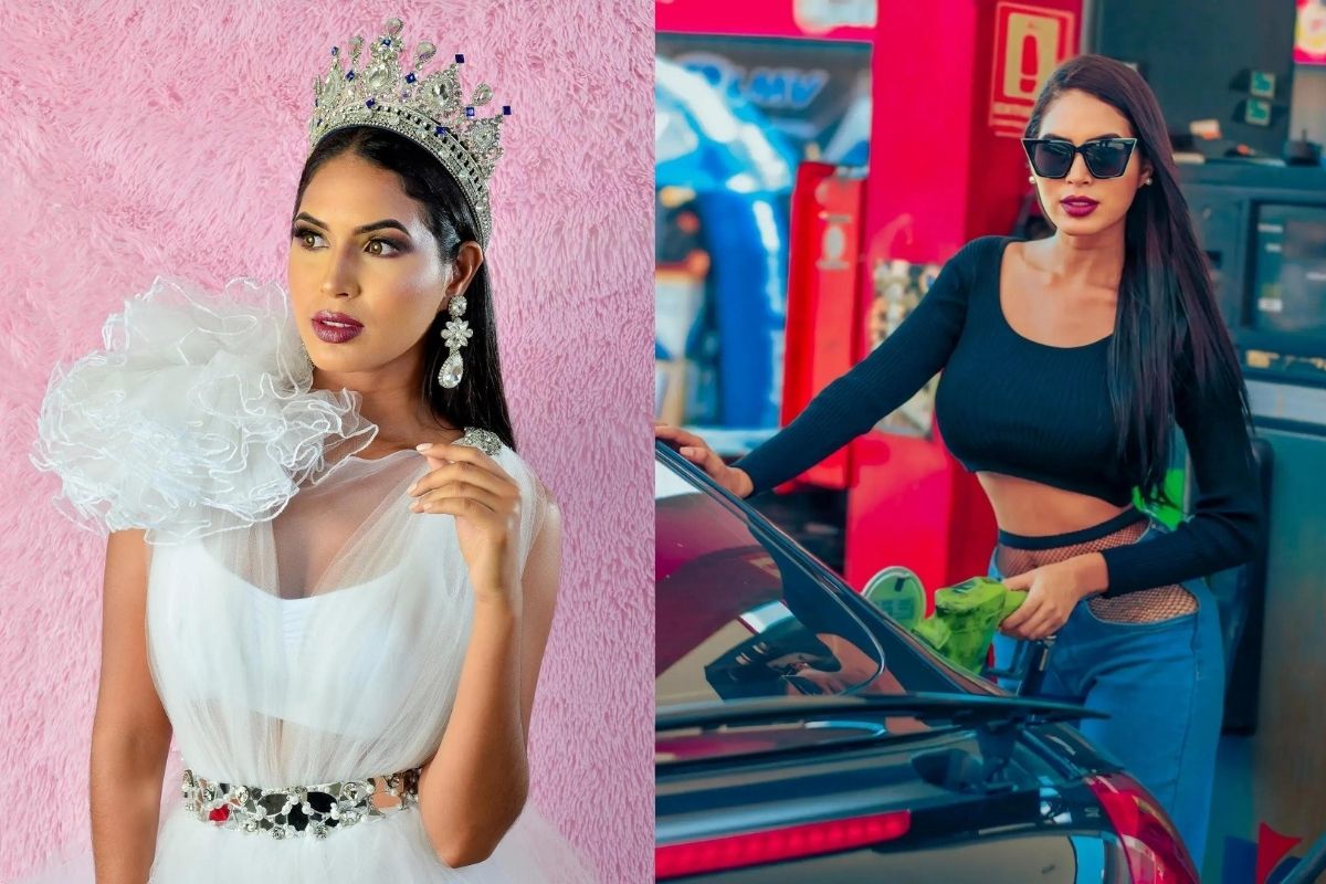 24 yaşındaki model estetik kurbanı oldu