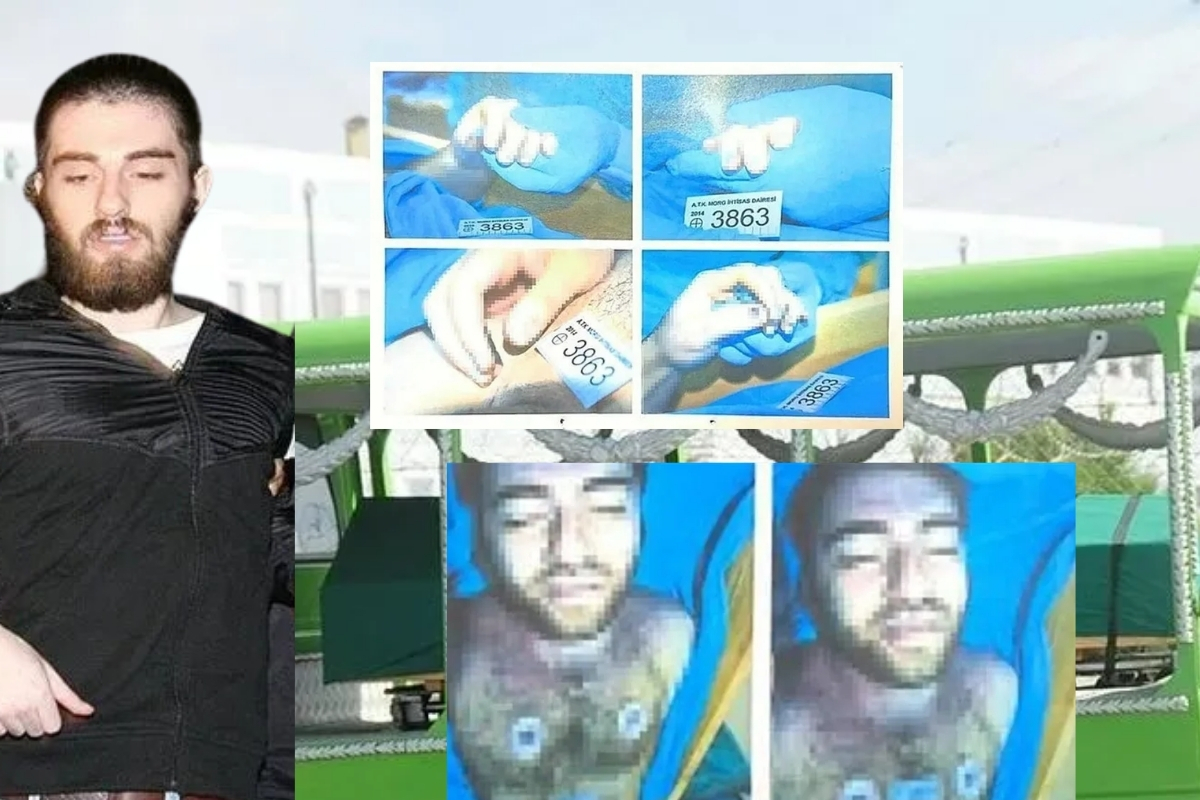 Cem Garipoğlu’nun elindeki mor lekelerin sırrı ortaya çıktı