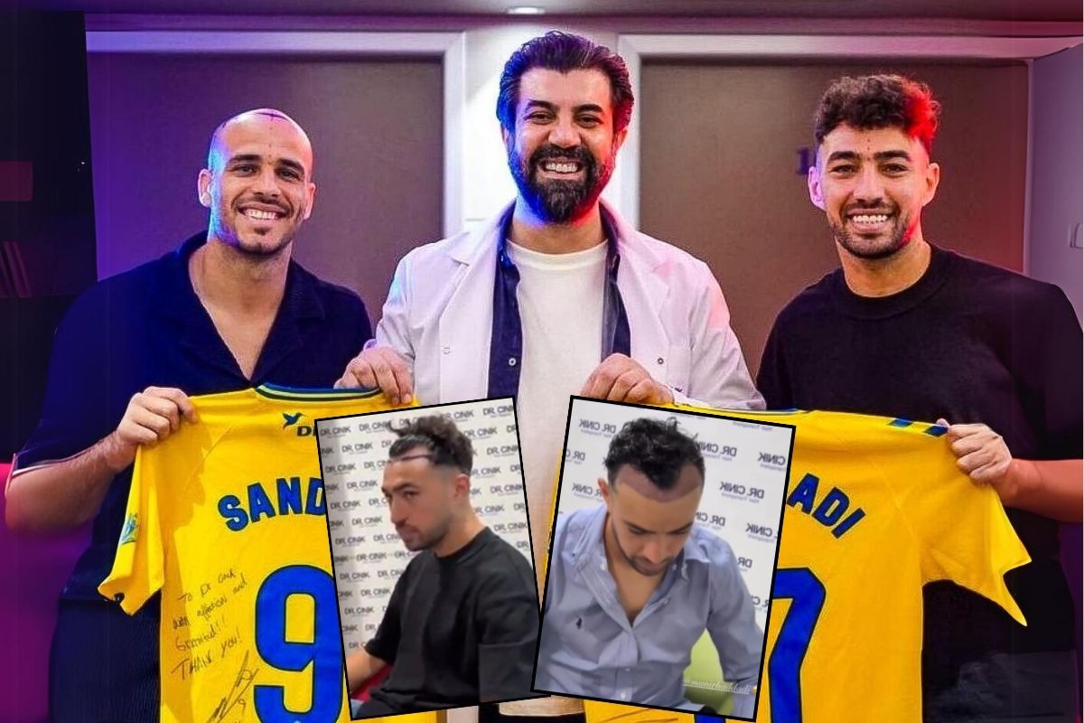 Las Palmaslı futbolcular saç ekimi için Türkiye'de