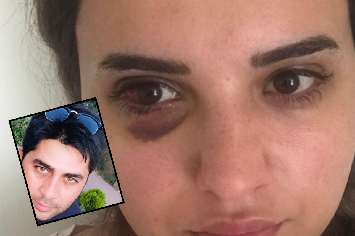 Boşanmak istediği kocası Leyla Akay'ı darp edip, bıçakladı