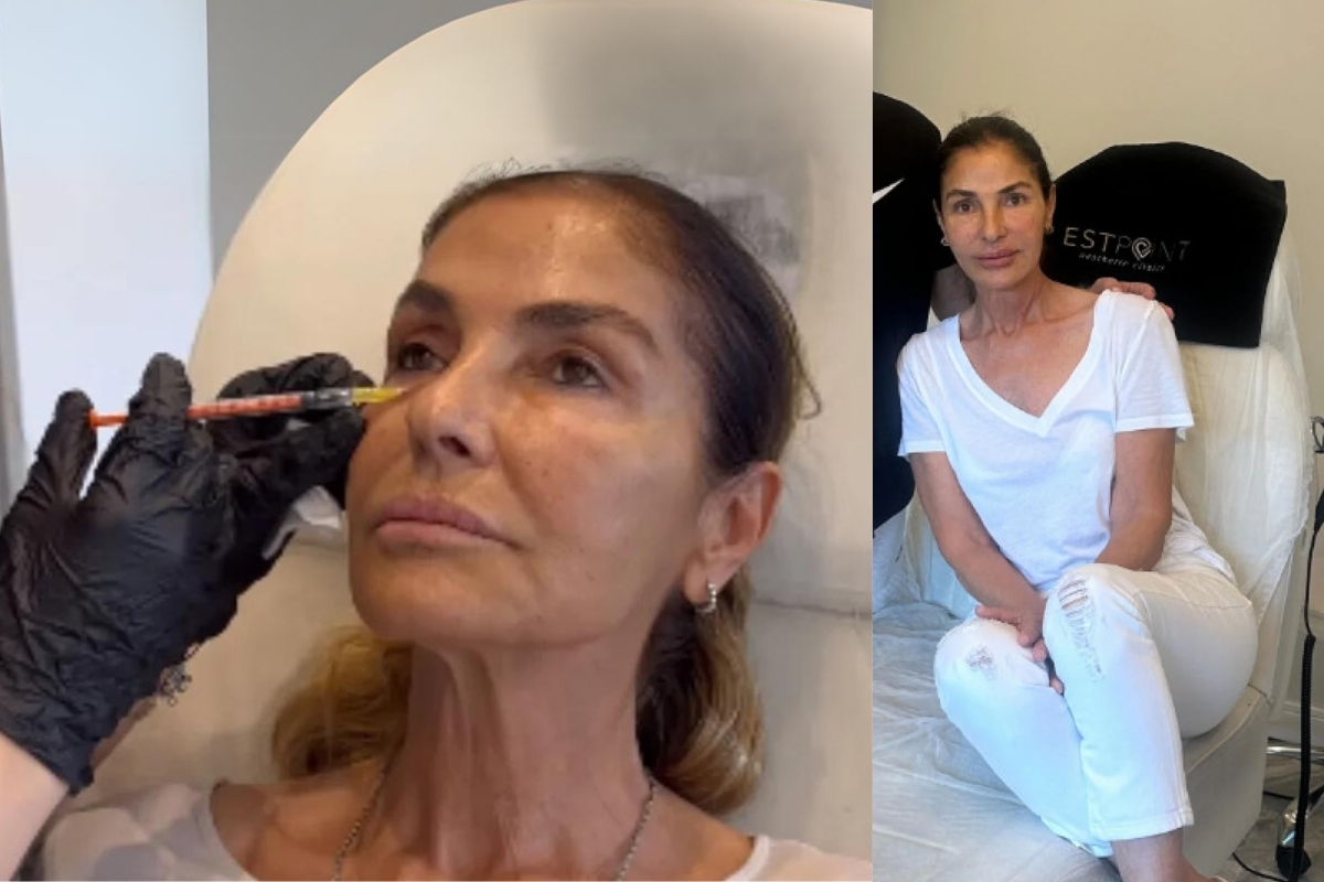 Derya Tuna'dan ameliyatsız estetik