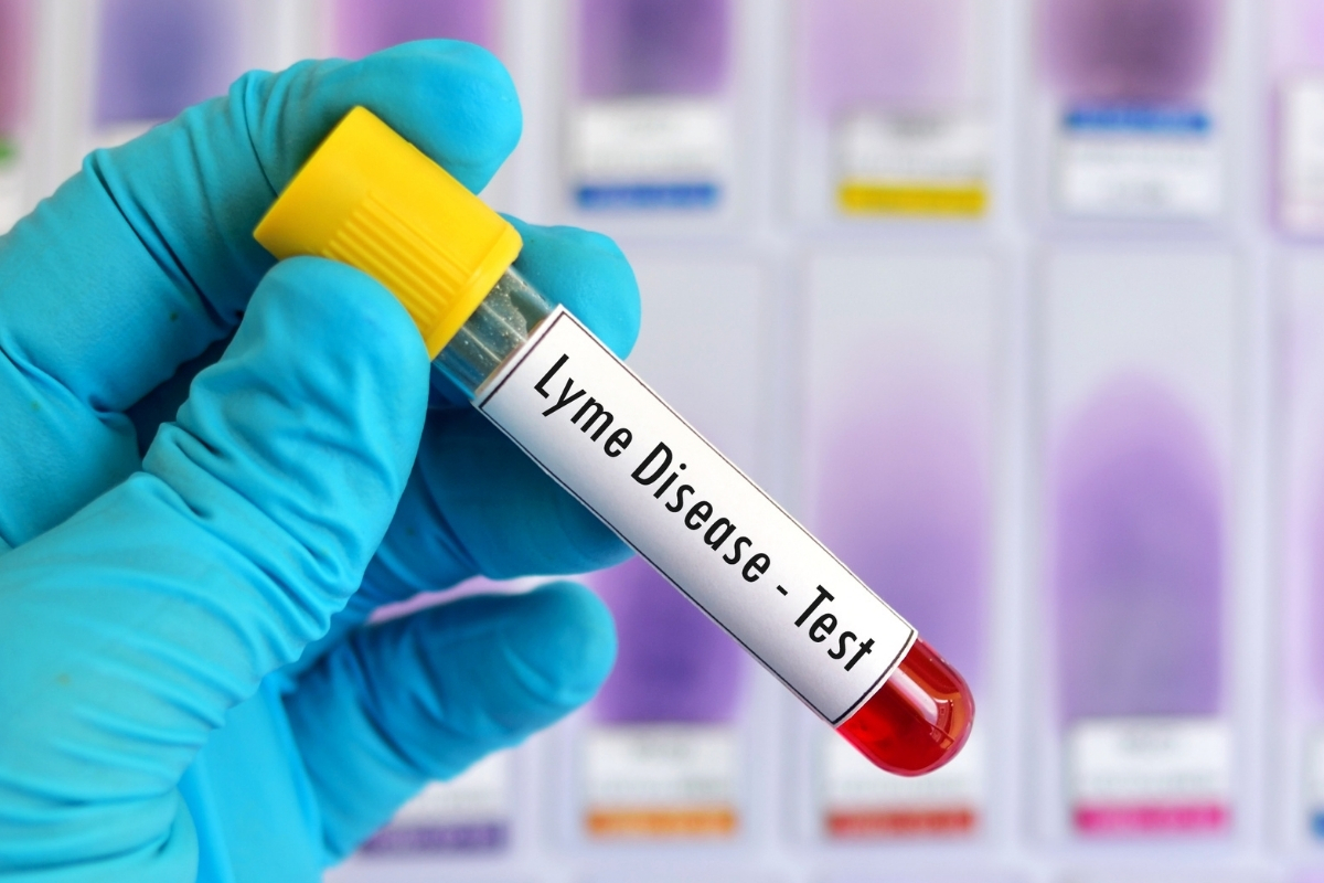 Zoonotik hastalıklardan biri olan Lyme, dünyanın bazı bölgelerinde alarm verdi