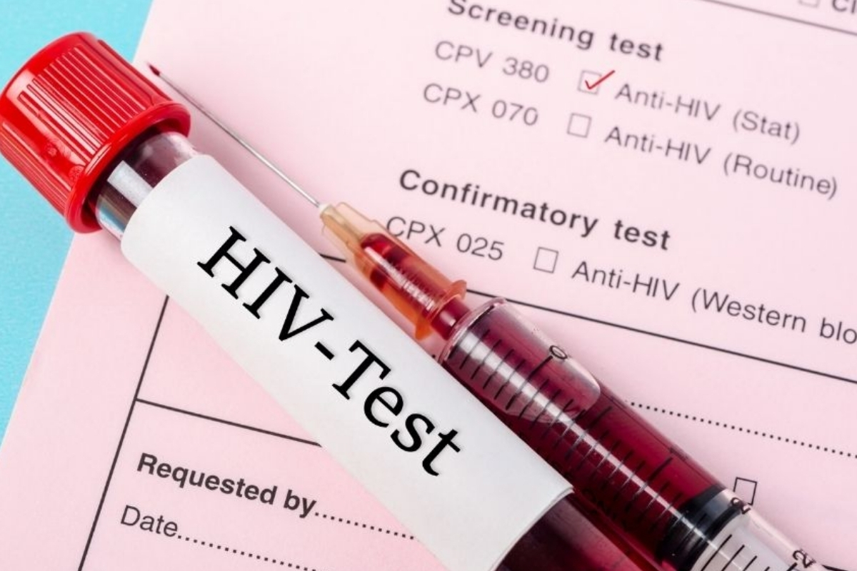 HIV pozitif olduğunu saklayan eşe 'kasten öldürmeye teşebbüs' suçundan dava