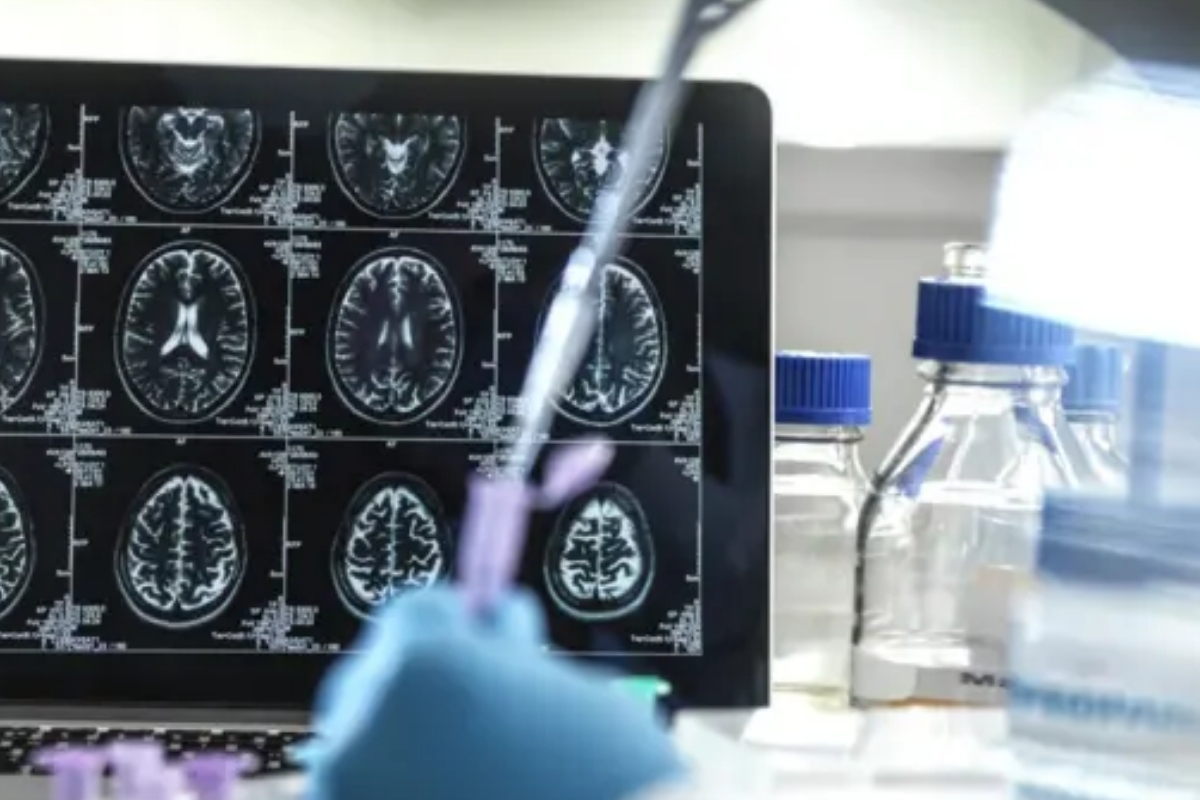 Alzheimer ilacı Donameab’a Avustralya onayı