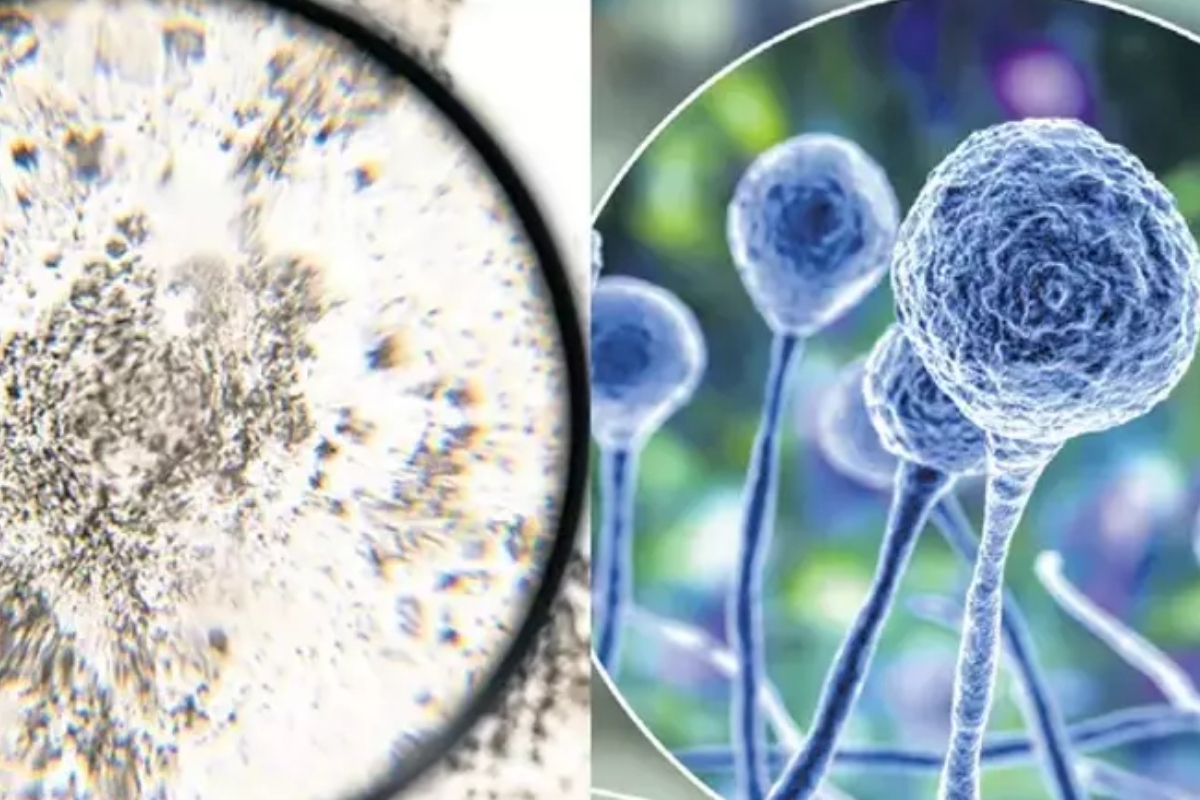 Küresel ısınmanın artışı, akciğerleri tüketen ölümcül Aspergillus mantarlarının Kuzey Amerika, Avrupa Ve Asya’da yayılmasını hızlandıracak