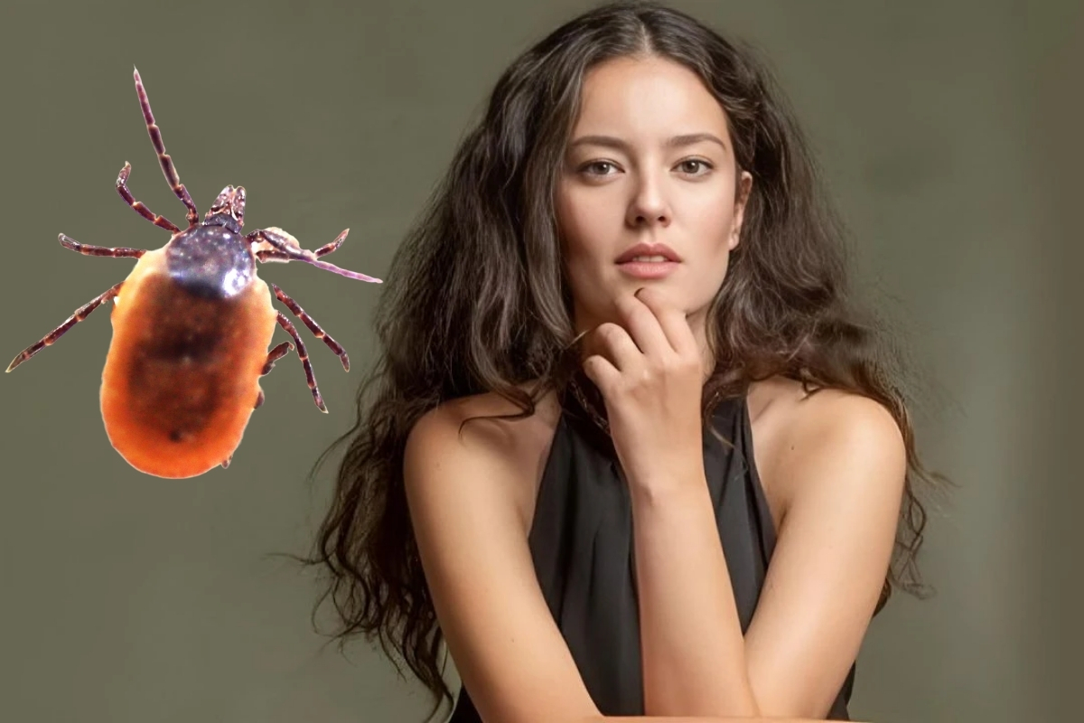 Oyuncu Pelin Akil'i kene ısırdı hastaneye koştu