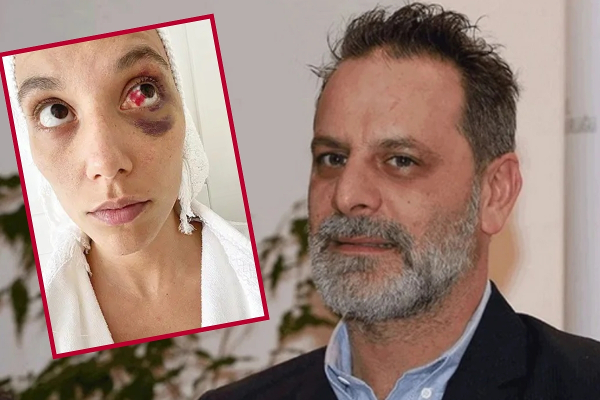 Ozan Güven, eski sevgilisi Deniz Bulutsuz’u kasten yaralama suçundan 2 yıl 3 ay hapis cezasına çarptırıldı