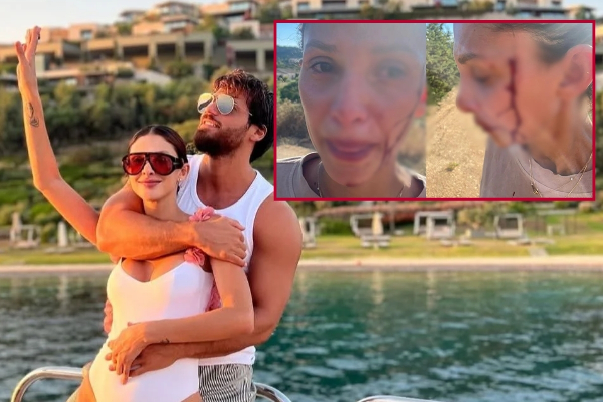 Can Yaman'ın sevgilisi Sara Bluma 'Artık susmayacağım' diyerek kanlar içinde paylaşım yaptı