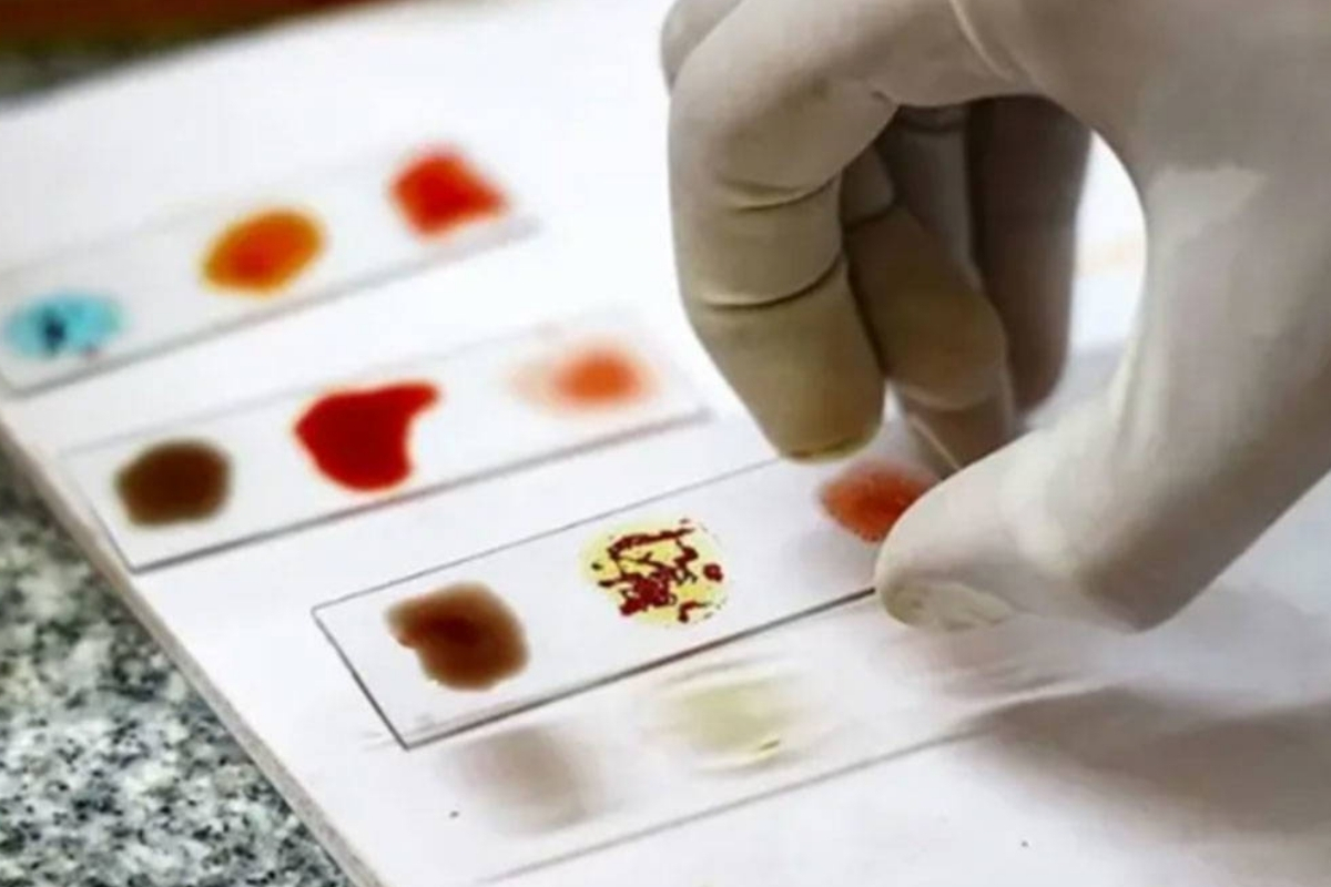 Dünyada sadece 50 kişide bulunan Rh null yani 'altın kan'ın laboratuvarda üretilmesi için çalışmalar hız kazanıyor