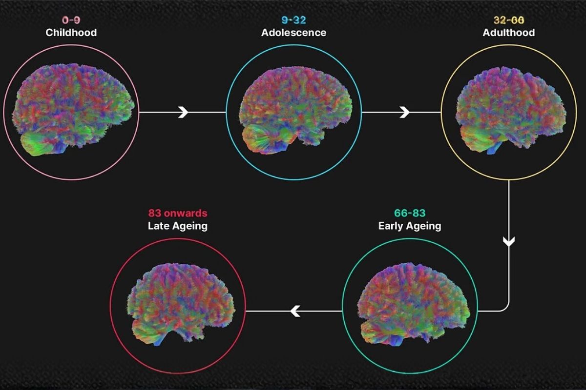 İnsan beyni 5 evreden geçiyor, 32 yaşına kadar ergenlik dönemini yaşıyor