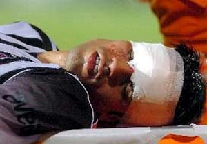 Milli Takım revire döndü, Terim'i sıkıntı bastı