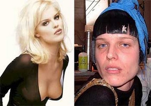 İşte ünlülerin gerçek yüzü