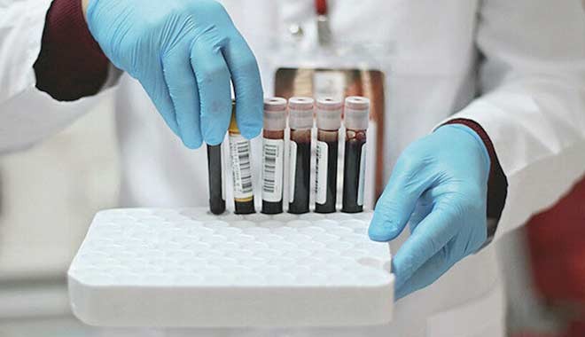 Yurt dışına çıkan korona testi için 110 TL ödeyecek