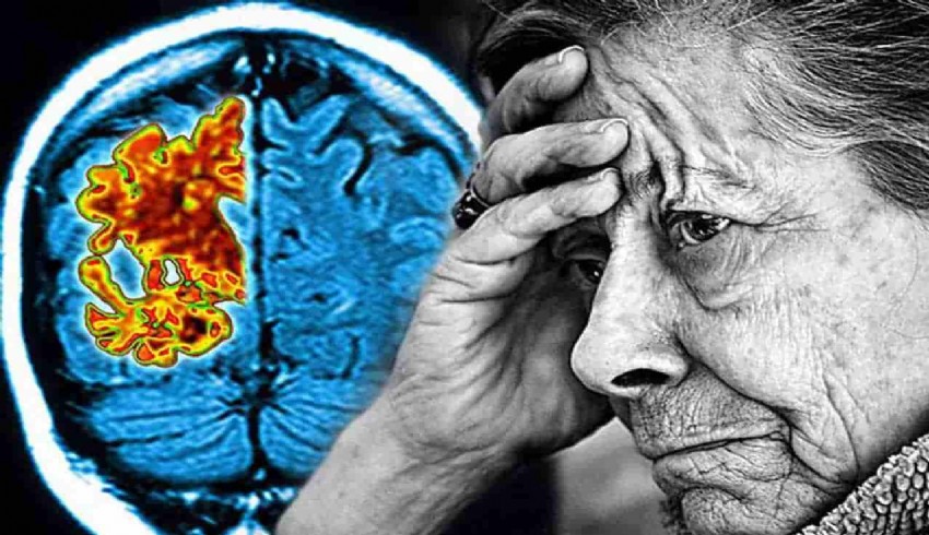 Akdeniz tipi diyet Alzheimer’a kalkan