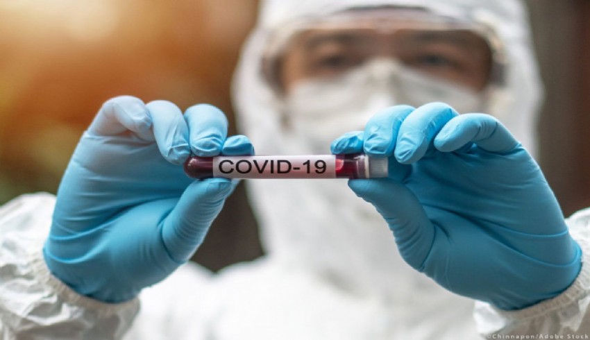 DSÖ: Kovid-19 vakalarında "endişe verici artış yaşanıyor