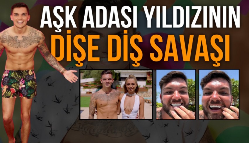 Netflix’de yayınlanan flört programı Love Island’ın yıldızı Sam Gowland, Türkiye’de dişlerini yaptırdı.
