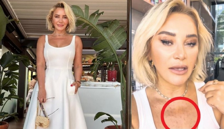 Sosyete genç kalmak için her yolu deniyor