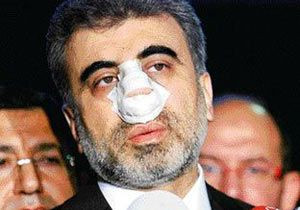 Bakan Yıldız'a yumruk örgüt işi çıktı