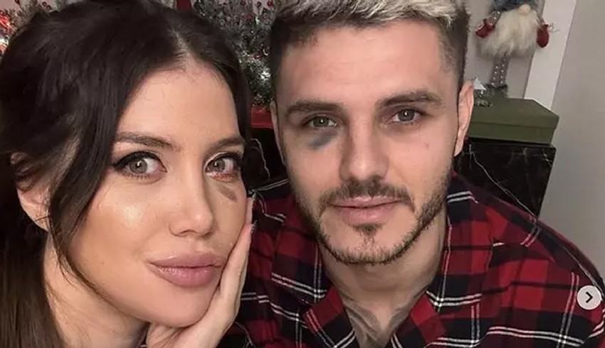 Wanda Nara, Icardi'nin gözündeki morluğu makyajla kapattı