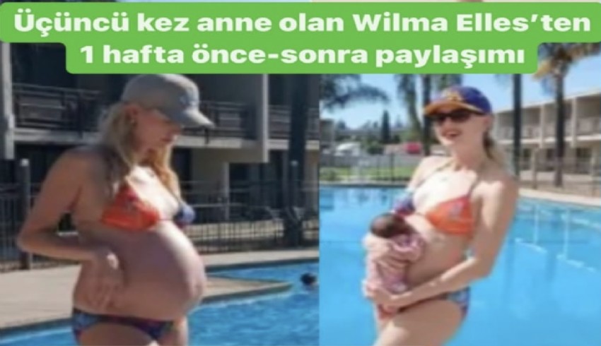 Wilma Elles'ten öncesi ve sonrası pozu